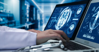 A doctor reviews digital brain scan images on a computer.