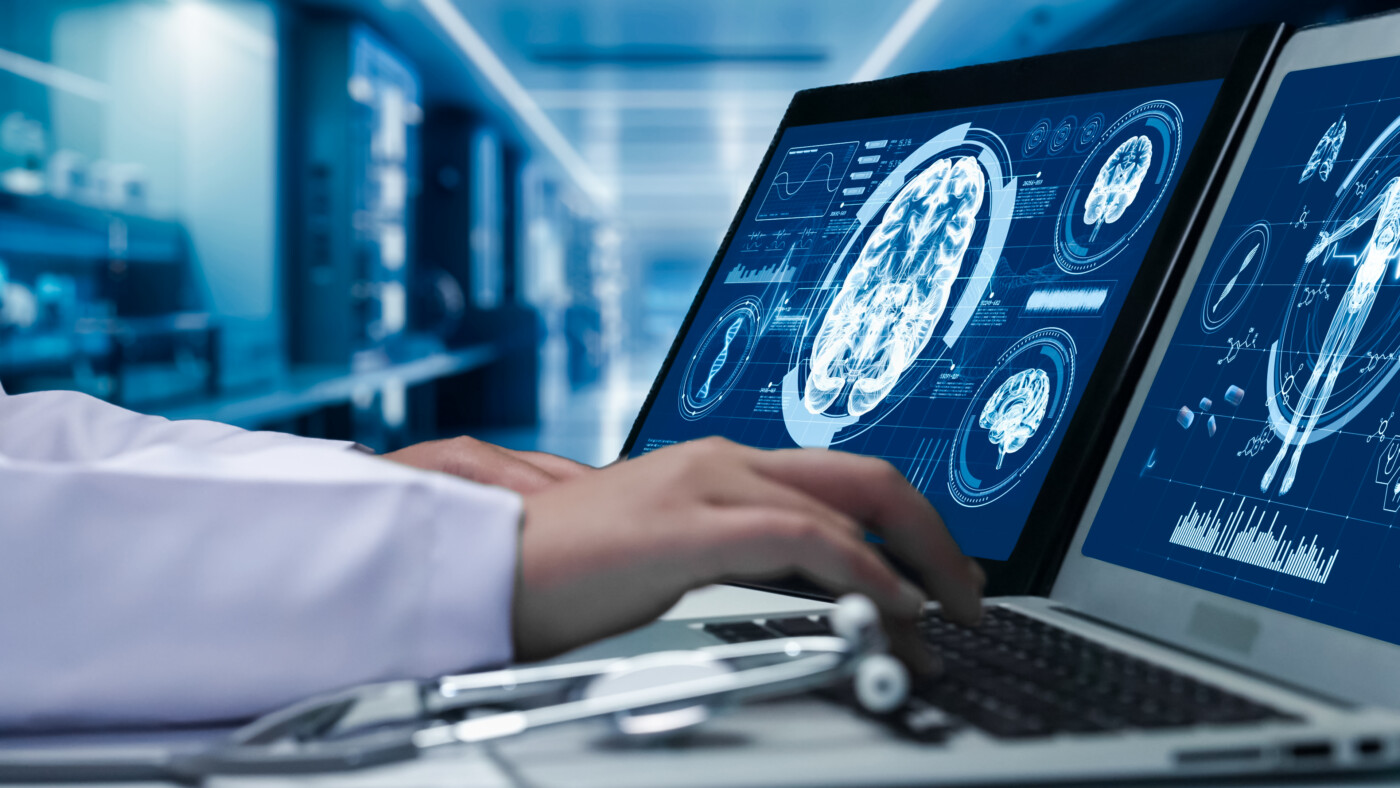 A doctor reviews digital brain scan images on a computer.