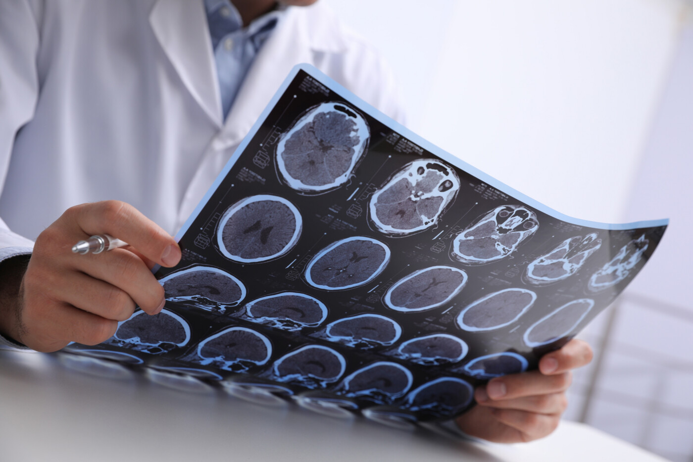 A doctor examines imaging scans of the brain.